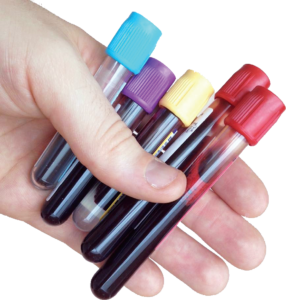 A person holding vacutainers that receive samples from syringes.