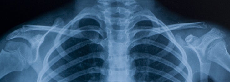 Photo of medical image of skeleton